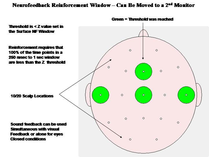 NF2- 19 Ch. LORETA Z-Score Neurofeedback