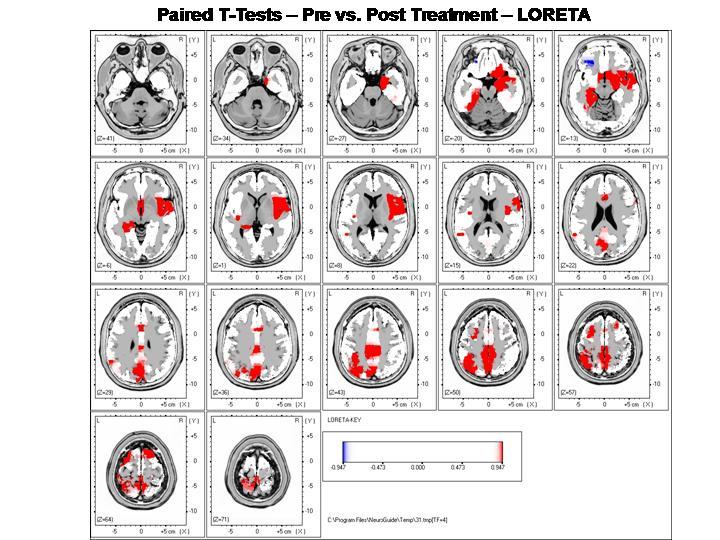 NeuroStat