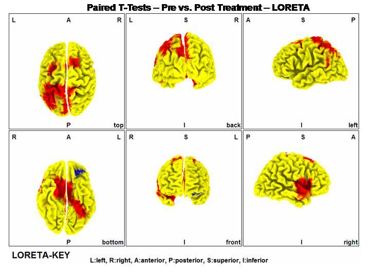 NeuroStat