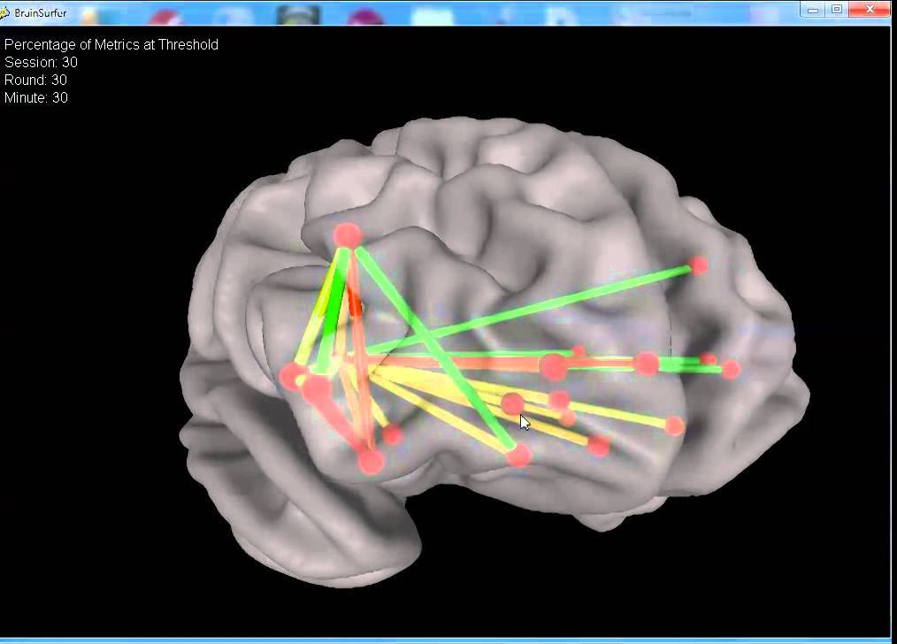 BrainSurfer Neurofeedback